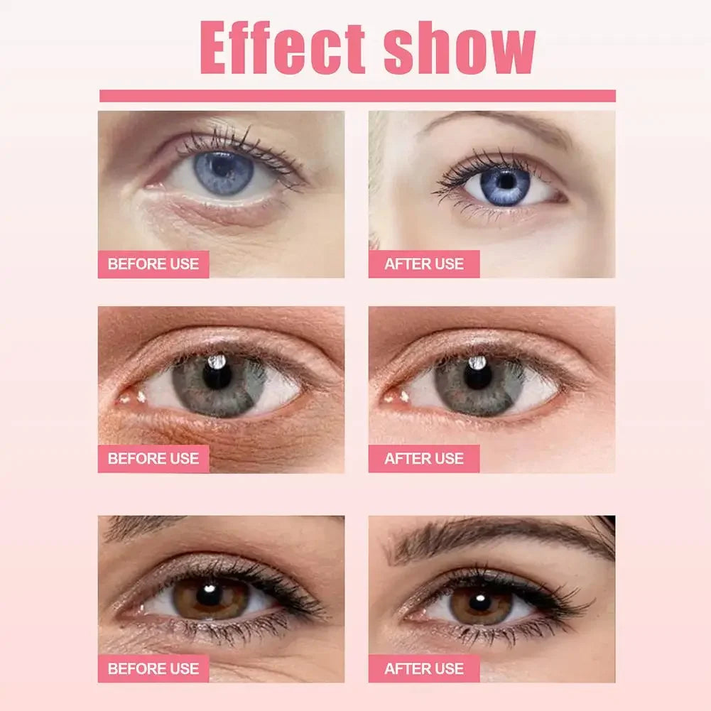 Rose Hyaluronic Acid Eye Cream Stick Moisturizing Anti-aging Firming Eye Eye Dark Firming Circles Moisturizing Remove Bags