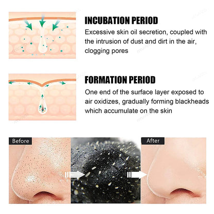 Unisex Deep Cleansing Nose Strips for Acne & Blackhead Removal Shrink Pore Nose Black Head Stickers Skin Care Patch